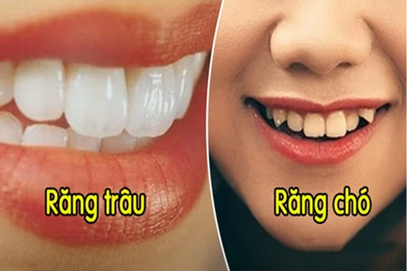 xem-tuong-rang-biet-ngay-van-menh-sang-hen-suong-kho.png